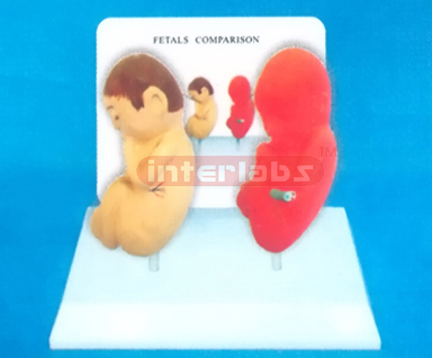 DESK-TYPE EMBRYO MODEL FOR COMPARISION DEMONSTRATING HEALTHMAN THAN SMOKING MAN WITH DESCRIPTION PLATE